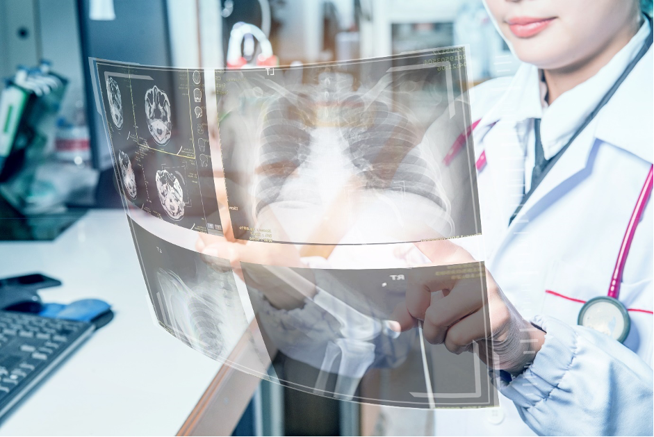 AI in Healthcare