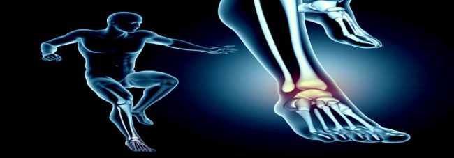 iFRD - Bone & Joint fracture detection