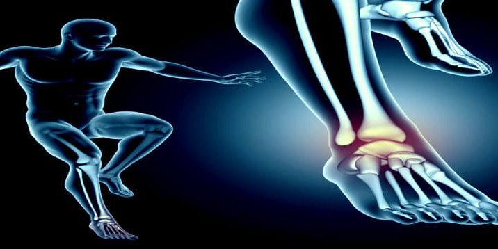 Bone & Joint-iFRD iFRD - Bone & Joint fracture detection