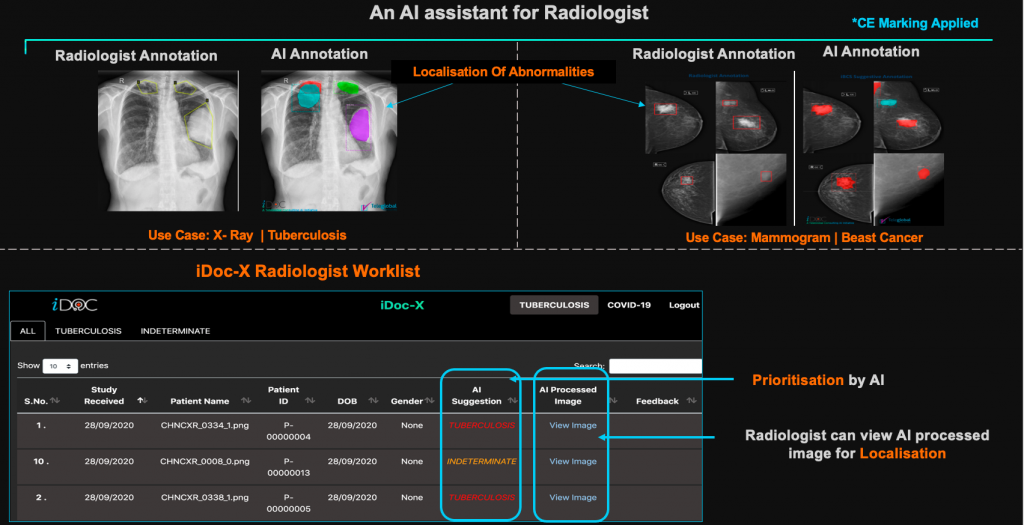 AI solution for CXRs (Chest X-Rays)